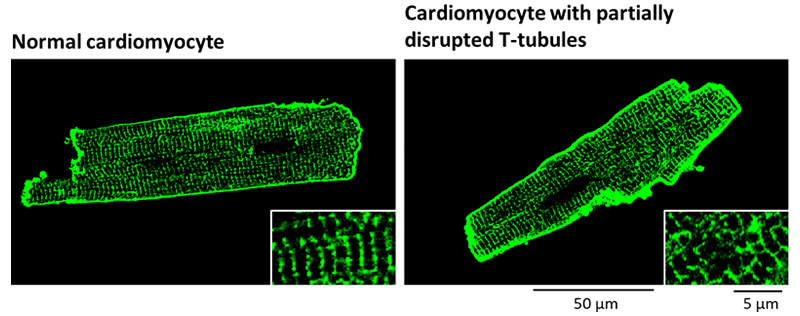 Membrane-stained image of a single cardiomyocyte. Normal cardiomyocytes (left) have periodic membrane structures (T-tubules). Cardiomyocytes with mechanical imbalances between the inside and outside of the cell (right) suffer partial disruption of their T-tubules, leading to heart failure.