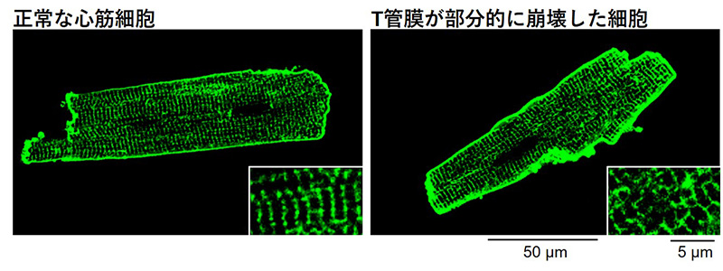 単体の心筋細胞の膜染色画像。正常な心筋細胞（左）には周期的な膜構造（T管膜）が存在している。
細胞内外の力学バランスが崩れた心筋細胞（右）は、T管膜が部分的に崩壊し、心不全を引き起こす。